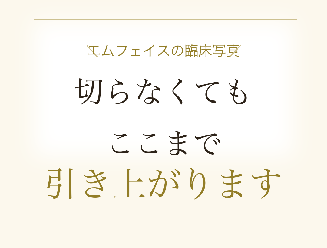 エムフェイスの症例。切らなくても、ここまで引き上がります。